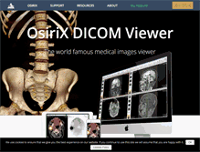 Tablet Screenshot of osirix-viewer.com